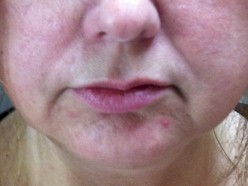 Corrected Asymetrical Cupids Bow